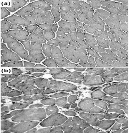 Fig. 3 Histology of 5 and 16 month-old mdx mice. Cryostat sections of (A) 5 and (B) 16 month-old mdx  mice intercostal muscles were subjected to Haematoxylin and eosin staining  