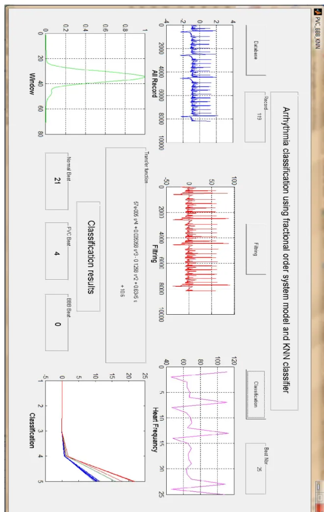 Fig ure ( IV.6) : Interface de classifica tion sous l’e nvironnement Matlab