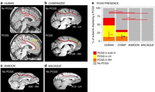 Fig. 1 Presence of the paracingulate sulcus (PCGS) across primates. The location of the cingulate sulcus (CGS) is shown in red in typical hemispheres displaying no PCGS and in those displaying a PCGS in human (a) and chimpanzee (b), as well as in typical h