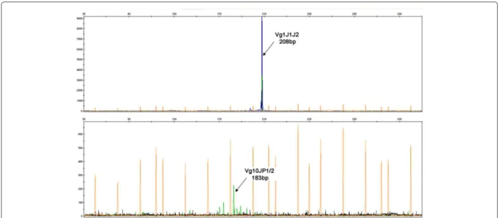 Figure 6 Fluorescent PCR of the diagnosis sample (Diag) of a patient with ALL. (Top) A 208-bp peak is detected with multiplex PCR of TRγ Vg1-10, corresponding to the main #01 clone TRGV5*01 -5/CC/0 TRGJ1*02