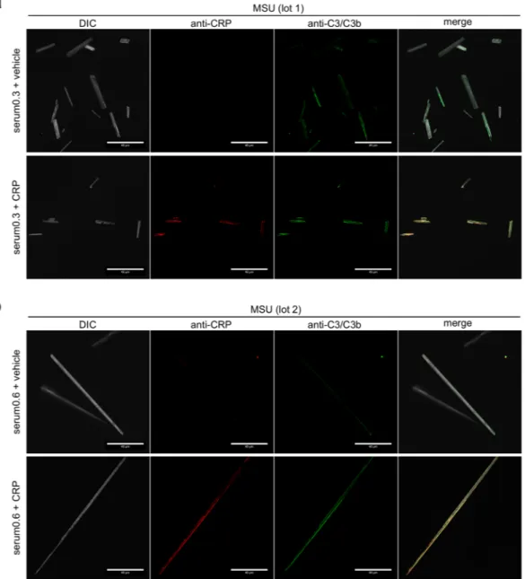 Figure 5.  Co-localization of CRP and C3 on opsonized MSU crystals. (a) Confocal microscopy of MSU crystals  (lot 1), which were incubated for 30 min at 37 °C with human serum (CRP 0.3 µg/ml) with or without addition  of 40 µg/ml purified CRP, washed exten