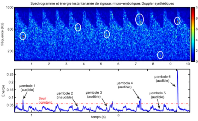 Figure 2 – D´ etection avec un seuil constant : spectrogramme (haut) et ´ energie instantan´ ee (bas).