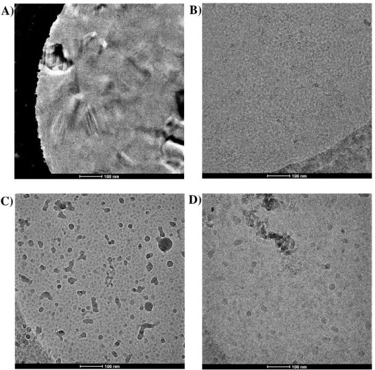 Figure  38  Image  des  contaminations  et  type  de  glace  en  EM.  A)  Concentration  élevée  de  saccharose dans l’échantillon, présence de glace