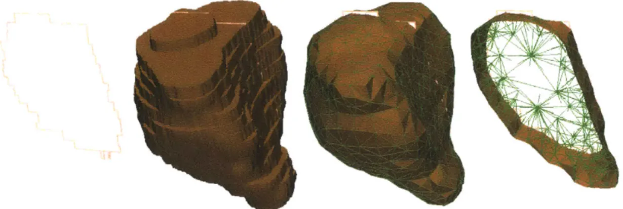 Figure  1-4:  Left:  Slice  through  a  voxel  representation  of  a  prostate.  Center  Left: