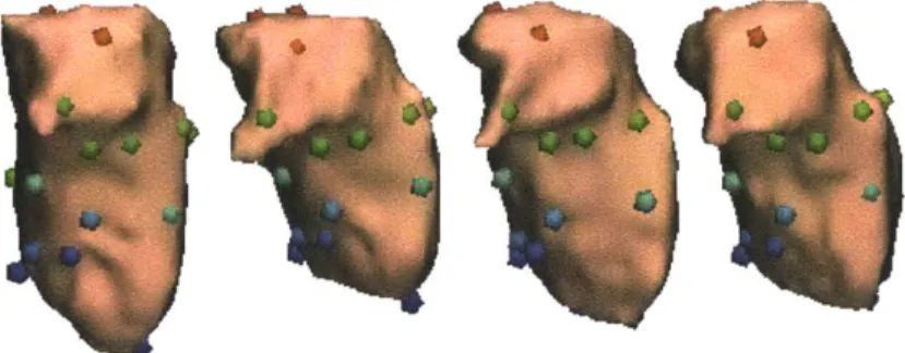 Figure  1-5:  The  surfaces  of  four  left  thalami  with  colored  spheres  indicating  corre- corre-spondences.