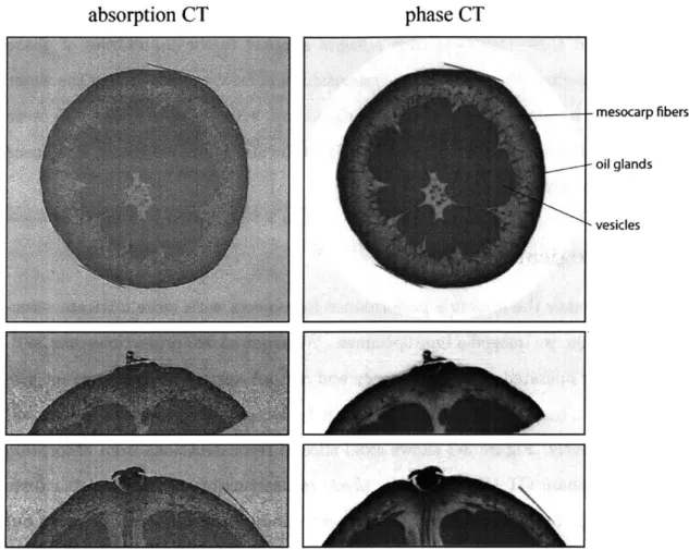 Figure  3-3:  Absorption  CT (left)  and phase  CT (right)  reconstructions  of a lime spec- spec-imen  shows  phase imaging  provides  superior  visualization  of fine  biological  structures compared  to  absorption  CT.