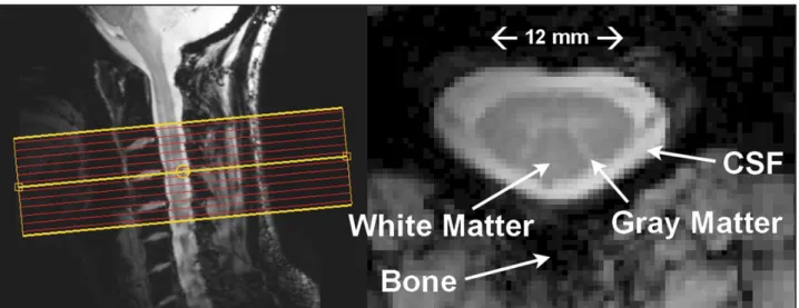 Figure 1: 7T cervical spinal cord MRI: sagittal T2-weighted image and T 2 * -weighted image (on the  right side) of the C3-C4 axial slice with identification of main anatomical components (Barry et al.,  2014)