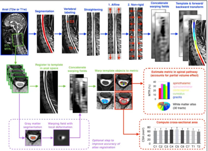 Figure 7: Representation of automated segmentation, vertebral level identification, co-registration of  different sequences and template-based analyses at the cervical SC level performed using the Spinal  Cord Toolbox software (De Leener et al., 2017)