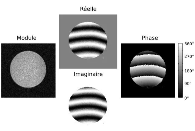 Figure 1.10: Les images de RMN sont présentées généralement comme des images en module (image de gauche) qui dépendent principalement des temps de relaxations T 1 et T 2 dans l'échantillon et des TE et TR sélectionnés