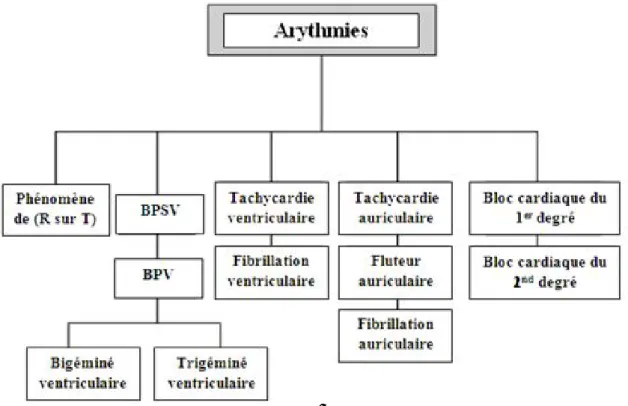 Figure 1.12. Différents types d’arythmies cardiaques [12]. 