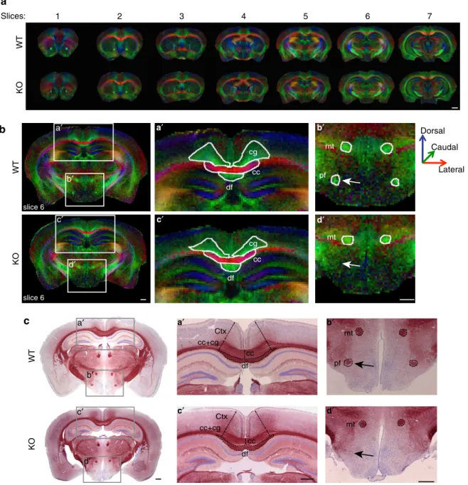 Figure 2 | Axonal tracts are defective in MAP6-KO mice. (a) Representative galleries of FA colour maps in which the colour code indicates the spatial direction of the free diffusion along the axons with medial-lateral (red), ventral-dorsal (blue) and rostr