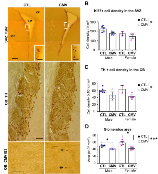 Figure 6. Long-lasting impact of CMV congenital infection on the adult OB.A, Representative staining of coronal SVZ (top) and OB (middle, bottom) slices with Ki67 (top), TH (middle) and murine CMV IE1 (bottom).B–D, Ki67 ⫹ cell densities in the SVZ (B), TH 