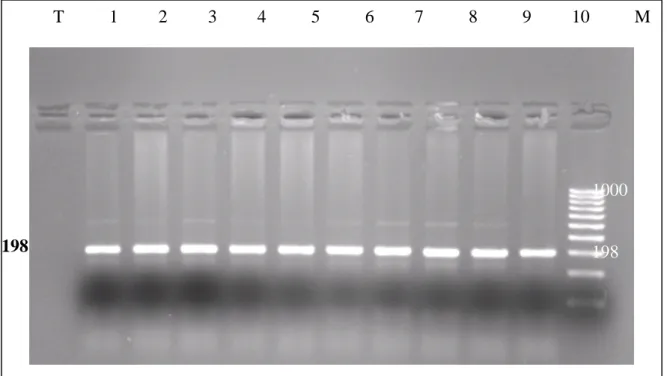 Figure  7 :  Profil  d’électrophorèse  sur  gel  d’agarose  1,5  %  des  fragments  amplifiés  (198 pb) par PCR du gène MTHFR