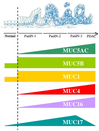 Figure 7. Profil d'expression des mucines au cours de la cancérogenèse pancréatique. 