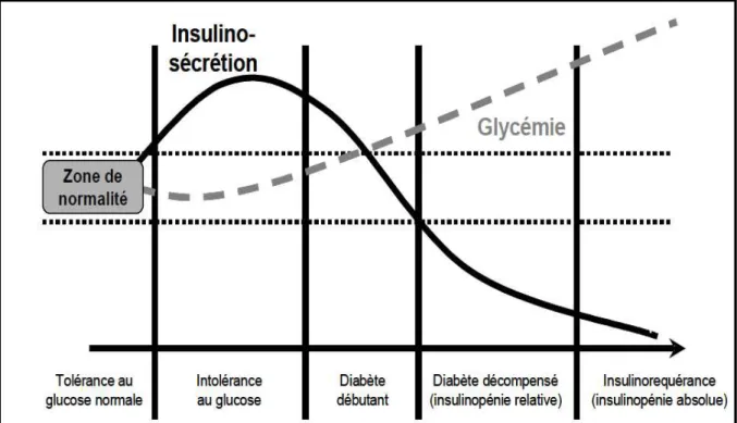 Fig. 4: Histoire naturelle du diabète de type 2 (Blicklé 1999 ) 