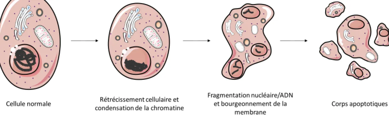 Figure  5  :  Aspects  morphologiques  du  processus  d'apoptose  d'une  cellule.  Les  changements  morphologiques de la cellule qui surviennent lors de la mort cellulaire apoptotique commencent par un  rétrécissement  cellulaire  et  une  condensation  d