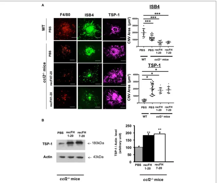 FIGURE 5 | FH increases TSP-1 level previously inhibited by microglia/macrophage cells recruitment (A) F4/80 (red), FITC-isolectin B4 (ISB4, green), and TSP-1 (purple) staining (day 14 postlaser) on CNV- ccl2 −/− mice lesion after recFH (1–20 or 7–20) IVT 