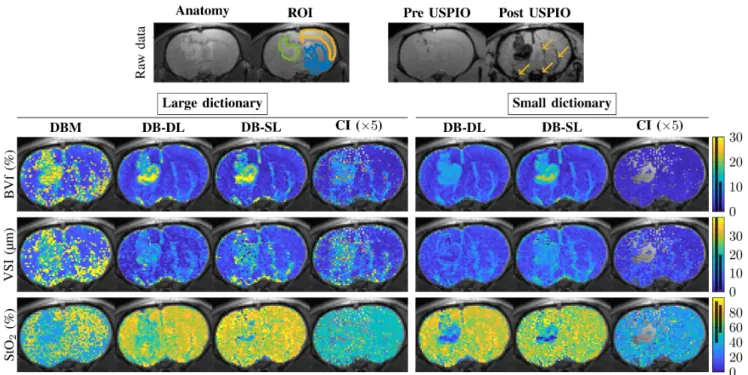Fig. 6. Maps of vascular parameter estimates of a 9L rat tumor model. The first row shows the anatomical image and regions of interest (left) and the MGEFIDSE pre and post USPIO injection (right) for the second echo time (6.3 ms)