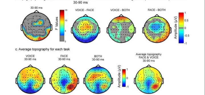 Figure 5 Attention modulated early brain activity (30-90 ms). (a) Topography of the average F-values in this time range