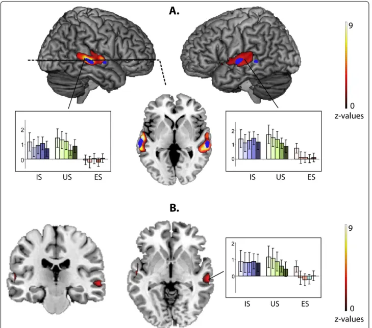 Figure 2 Effect of stimulus Category. A. Main effect of stimulus category. Vocoder degraded speech (degraded IS and US) vs