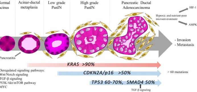 Figure  2.  Schematic  representation  of  genetic  and  signaling  pathways  alterations  in  PDAC  carcinogenesis