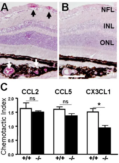 Figure 3: Localization of the chemokine CX3CL1 and  in vitro  migration assay. 