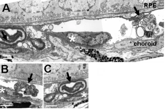 Figure 5 : ROS remnants in electron microscopy. 