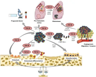 Figure 3. The  central  role of  TGF‐β  in osteosarcoma tumor and metastases  development. Roles  of  TGF‐β  as  a  main  player  in  the  vicious  cycle  between  osteosarcoma  cells  and  the  bone  tumor  microenvironment,  thus  contributing  to  tumor