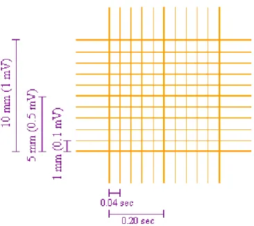 Figure 6: Les lignes temps et voltage de l’ECG (51) 
