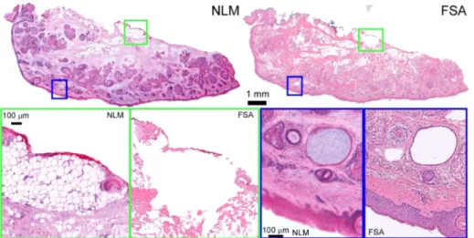 Fig. 2. Normal skin removed during Mohs surgery. High magnification of adipose tissue (green inset), shows adipocytes with red surgical marking ink