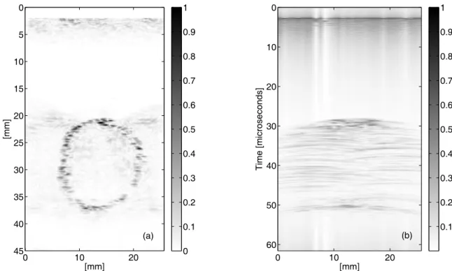Figure 4: The topological derivative G e (a) obtained from RF signals whose envelopes are presented in (b)