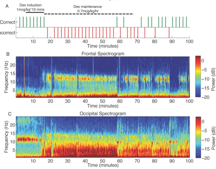Figure 1. Representative behavioral response, along with frontal and occipital spectrograms  during the dexmedetomidine study