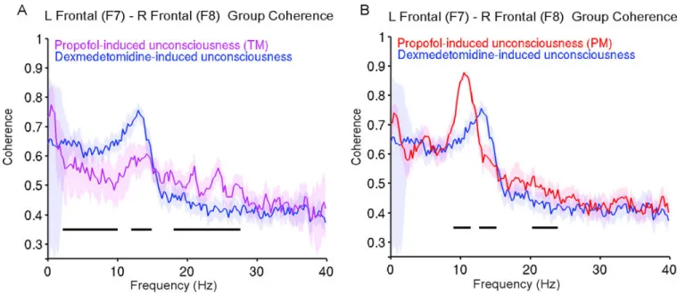 Figure 7. Group level coherence analyses comparing dexmedetomidine-induced unconsciousness  to propofol-induced unconsciousness (TM) and propofol-induced unconsciousness (PM)