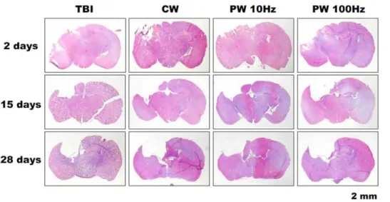 Figure 8. Area of brain lesions. Results of quantitative analysis of the area of cavitary cortical lesions in brain tissue on the basis of the histological images