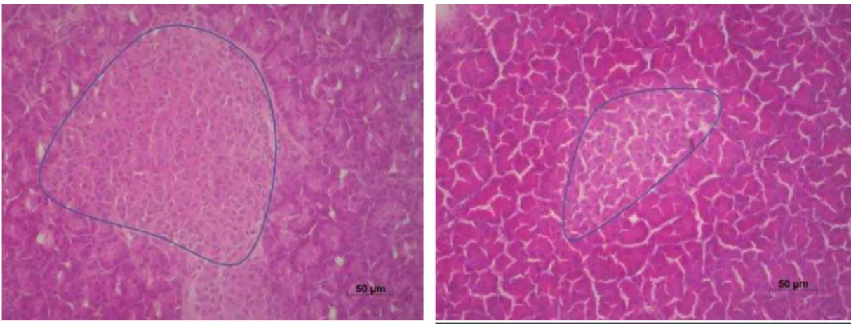 Figure 14. Coupes histologiques de pancréas avec un ilot entouré en bleu d'un raton CT (à  gauche) et d'un raton TR (à droite)