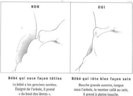 Figure 2 Position de l’enfant au sein, d’après « l’allaitement, de la naissance au  sevrage », Dr Marie Thirion (2004) 