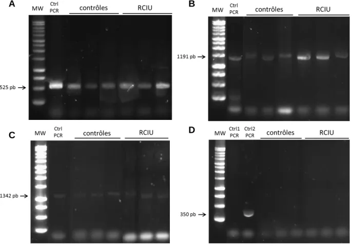 Figure 3. Résultats de migration des produits de PCR. PCR « GFP » pour l’insertion du  transgène (A)