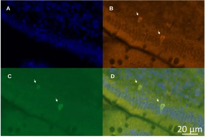 Figure  5.  Visualisation  des  cellules  d’intérêt  en  microscopie  à  fluorescence