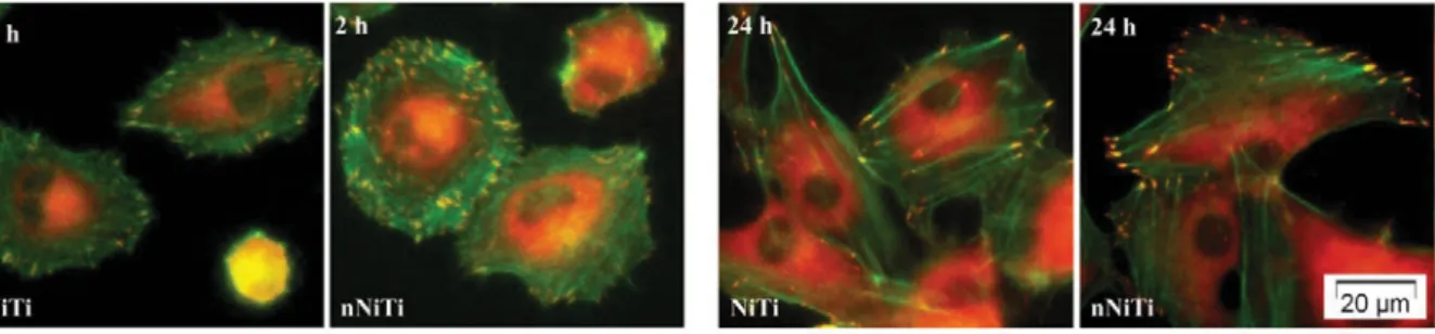 Fig. 5. Merged fluorescence images of actin filaments (green) and vinculin (red) in HUVEC cells  grown on NiTi and nNiTi surfaces