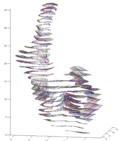 Fig. 16: trajectoires de la déformations du sujet S1 pour la construction de la population S1A  dé-crite ci-après