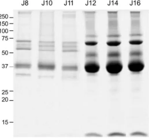 Figure 2 :  Analyse  SDS-PAGE  du liquide amniotique de poule du 8 ème  au  16 ème   jour du  développement  embryonnaire (J8 à J16)