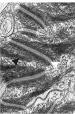 Figure 8. Photo de la couche épineuse de l’épiderme avec les filaments intermédiaires de kératines   Filaments intermédiaires de kératines (flèche noire) insérés à des desmosomes (flèche blanche) dans un 