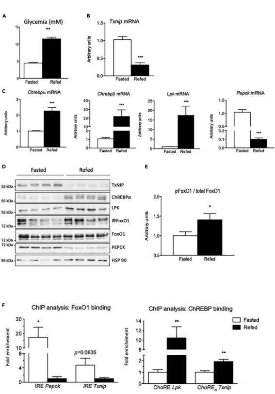 Figure 4. Differential regulation of TxNIP during fasting and refeeding. Adult C57BL/6J male mice were studied under fasting (24 h fast) or refed (a 18-h refeeding period) at ZT12