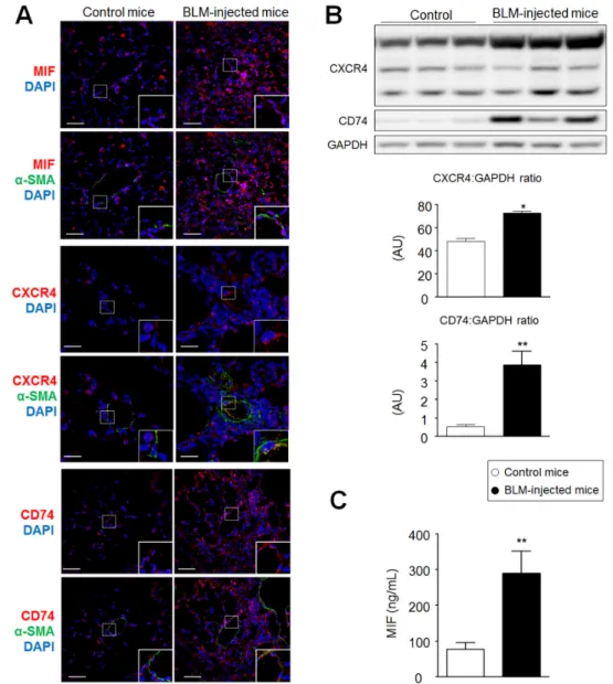 Figure 2. Increased expression of macrophage migration inhibitory factor (MIF), CXCR4, and CD74  in lungs from bleomycin (BLM)-injected mice