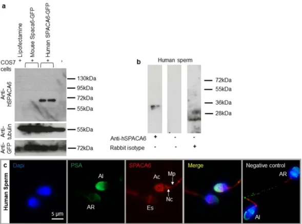 Figure 1.  Human sperm SPACA6 expression. (a) Western blot using extracts of COS-7 cells transfected or  not with mouse Spaca6-GFP and human SPACA6-GFP, revealed with rabbit polyclonal anti-human SPACA6,  anti-Tubulin and anti-GFP antibodies