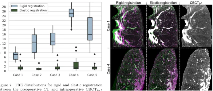 Figure 7: TRE distributions for rigid and elastic registration between the preoperative CT and intraoperative CBCT inf