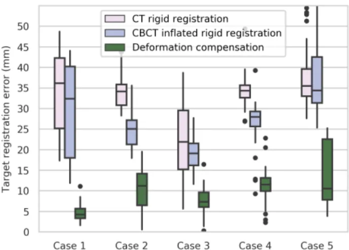 Figure 9: TRE distributions for our complete deformation compensation framework, alongside the errors expected  with-out deformation compensation