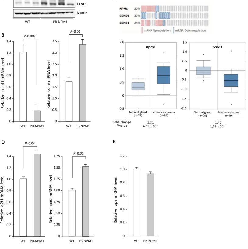 Figure 3. NPM1 stimulates E2F1 target genes expression. A. Western blot analysis of cyclin E1 protein accumulation in ventral prostate of 16 months old wild type and PB-NPM1 transgenic mice