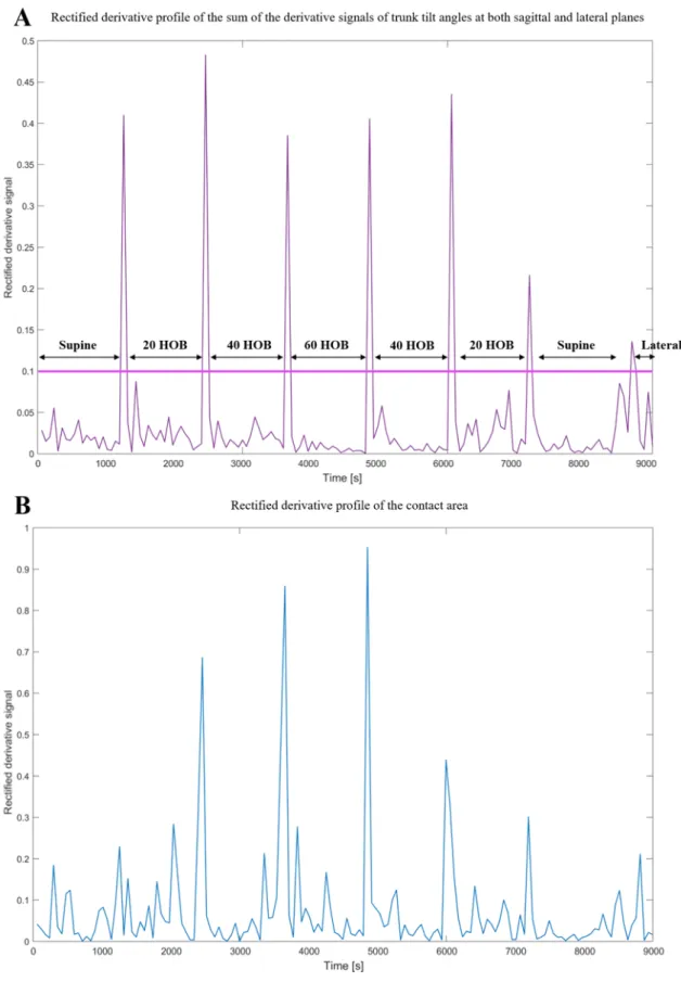 Fig. 3: Rectified derivative profile for subject #1 in the test cohort of A) the sum of the derivative  signals of trunk tilt angles at both sagittal and lateral planes, B) contact area