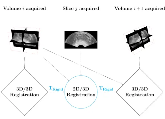Figure 2. Workflow of the biopsy procedure